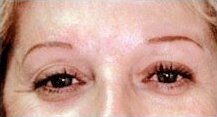 Eyebrows after