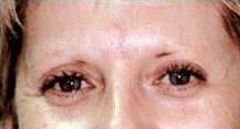 Eyebrows before